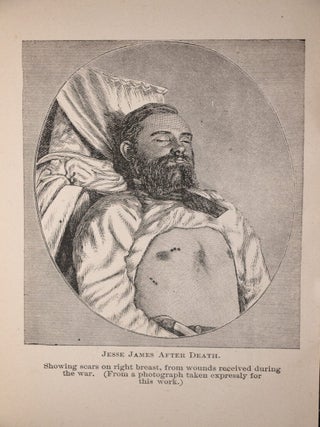 Illustrated Lives and Adventures of Frank and Jesse James and the Younger Brothers, The Noted Western Outlaws